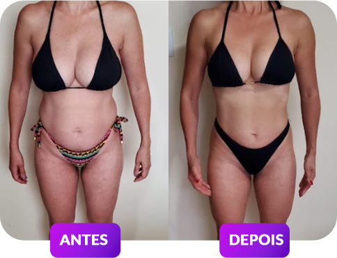 antes e depois-1